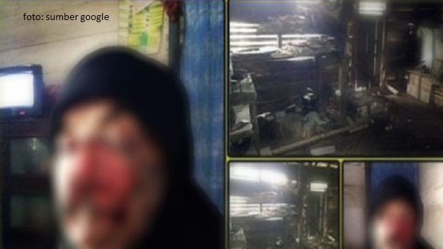 Uluran Tangan Untuk Bantu Nenek Ratma Penderita Kanker Kulit