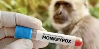 Diskes Klaim Belum Temukan Kasus Monkeypox di Lampung